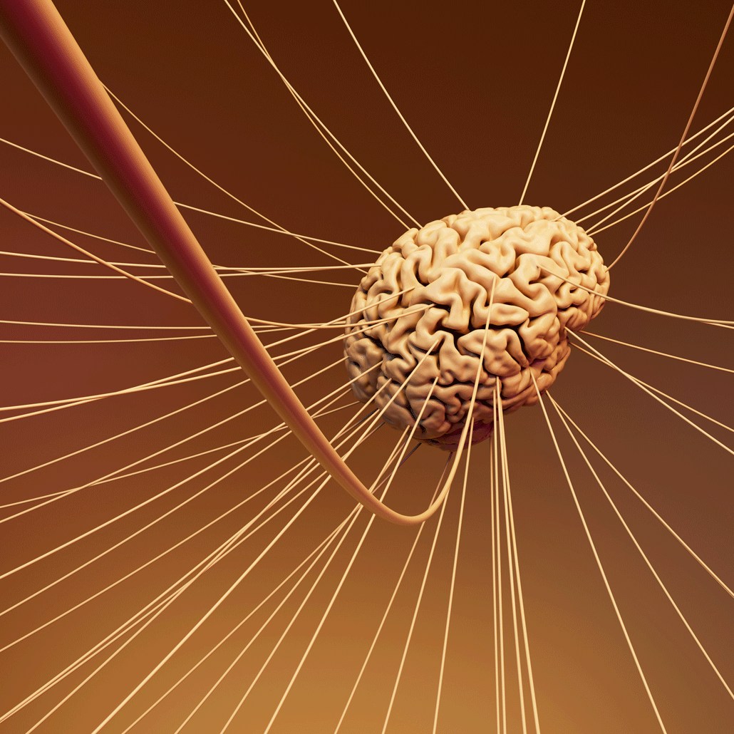 Weltschlaganfalltag 2025